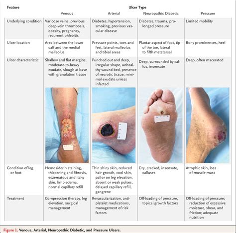 pain in left foot icd 10|icd 10 left forefoot pain.